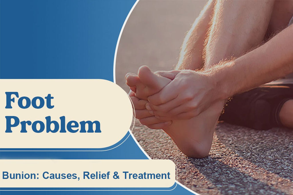 Bunion: Causes, Relief & Treatment - FitVille
