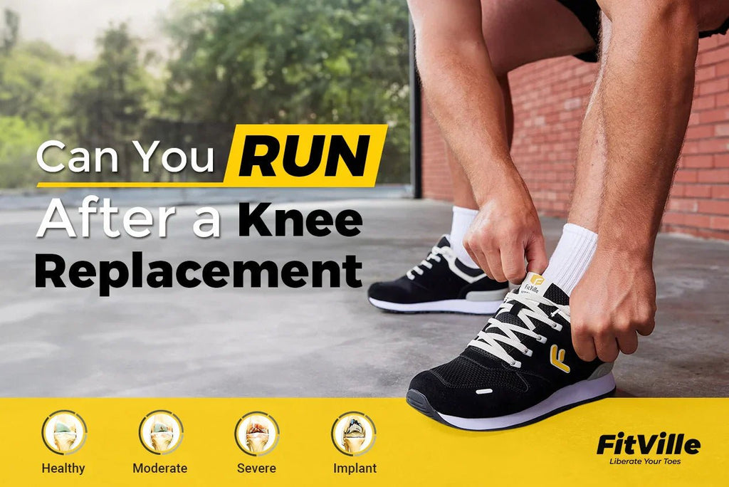 Can You Run After a Knee Replacement? - FitVille