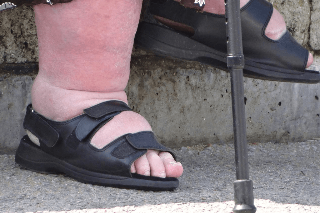 Are 6E shoes The Solution to Your Swelling Feet? - FitVille