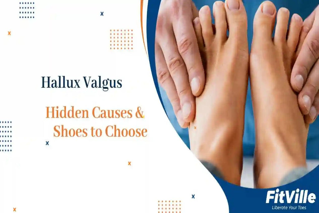 Hallux Valgus: 4 Hidden Causes and the Best Shoes to Choose - FitVille
